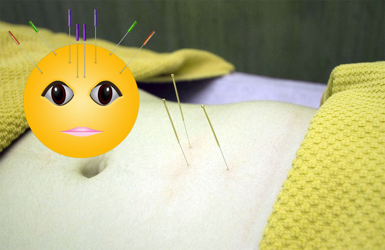 acupuncture